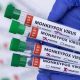 22 cas de variole du singe ont été enregistrés en Afrique du Sud